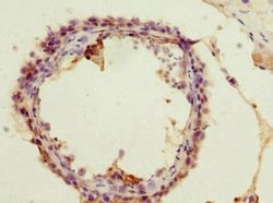 Invitrogen ACSS2 Polyclonal Antibody 100 &mu;L; Unconjugated:Antibodies,