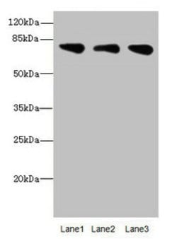 Invitrogen ACSS2 Polyclonal Antibody 100 &mu;L; Unconjugated:Antibodies,
