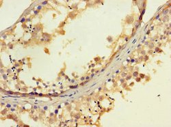 Invitrogen EXD2 Polyclonal Antibody 100 &mu;g | Buy Online | Invitrogen&trade; | Fisher Scientific