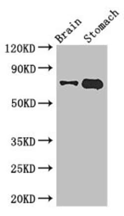 Invitrogen EXD2 Polyclonal Antibody 100 &mu;g | Buy Online | Invitrogen&trade; | Fisher Scientific