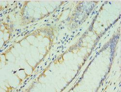 Invitrogen TMOD3 Polyclonal Antibody 100 &mu;L; Unconjugated:Antibodies,