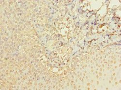 Invitrogen ABI3 Polyclonal Antibody 100 μg; Unconjugated:Antibodies,