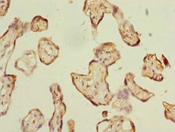 Invitrogen ABI3 Polyclonal Antibody 100 μg; Unconjugated:Antibodies,
