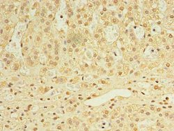 Invitrogen UTP23 Polyclonal Antibody 100 μg; Unconjugated:Antibodies,