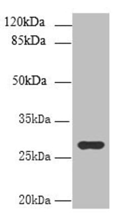 Invitrogen UTP23 Polyclonal Antibody 100 μg; Unconjugated:Antibodies,