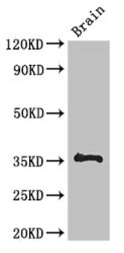 Invitrogen NPL Polyclonal Antibody 100 &mu;g; Unconjugated:Antibodies,