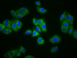 Invitrogen SLC4A5 Polyclonal Antibody 100 μg; Unconjugated:Antibodies,