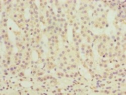 Invitrogen OR2H1 Polyclonal Antibody 100 &mu;g | Buy Online | Invitrogen&trade; | Fisher Scientific