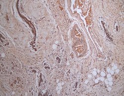 Invitrogen MCAR1 Polyclonal Antibody 100 &mu;g; Unconjugated:Antibodies,
