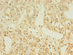 Invitrogen C2orf43 Polyclonal Antibody 100 &mu;g; Unconjugated:Antibodies,