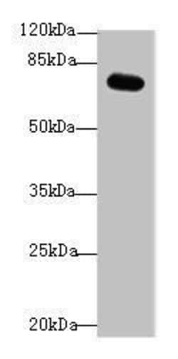 Invitrogen RMI1 Polyclonal Antibody 100 &mu;g; Unconjugated:Antibodies,