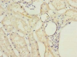 Invitrogen MRPL22 Polyclonal Antibody 100 &mu;g; Unconjugated:Antibodies,