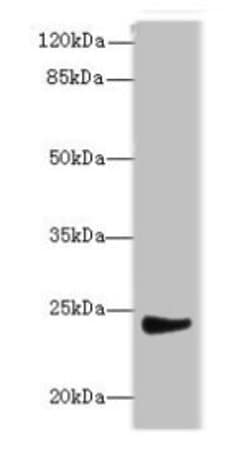Invitrogen MRPL22 Polyclonal Antibody 100 &mu;g; Unconjugated:Antibodies,