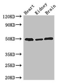 Invitrogen ANKRD10 Polyclonal Antibody 100 &mu;g | Buy Online | Invitrogen&trade; | Fisher Scientific