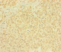 Invitrogen BTG4 Polyclonal Antibody 100 &mu;g; Unconjugated:Antibodies,