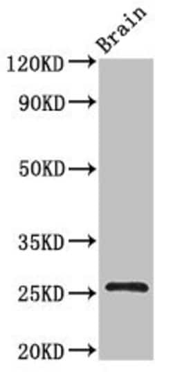 Invitrogen BTG4 Polyclonal Antibody 100 &mu;g; Unconjugated:Antibodies,