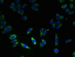 Invitrogen FKBP11 Polyclonal Antibody 100 &mu;g; Unconjugated:Antibodies,