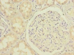 Invitrogen C20orf72 Polyclonal Antibody 100 &mu;g; Unconjugated:Antibodies,