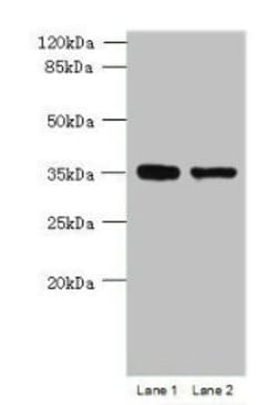 Invitrogen C20orf72 Polyclonal Antibody 100 &mu;g; Unconjugated:Antibodies,