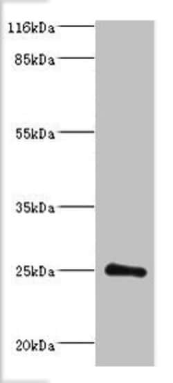 Invitrogen DGCR6L Polyclonal Antibody 100 &mu;g; Unconjugated:Antibodies,