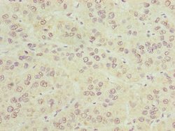 Invitrogen CIPC Polyclonal Antibody 100 &mu;g; Unconjugated:Antibodies,