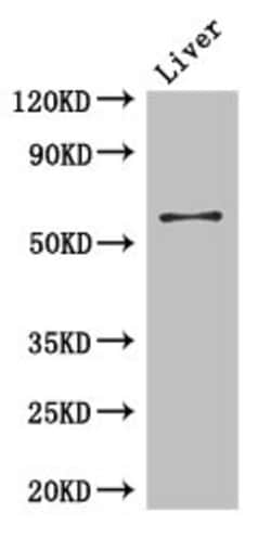 Invitrogen CCDC8 Polyclonal Antibody 100 &mu;g | Buy Online | Invitrogen&trade; | Fisher Scientific