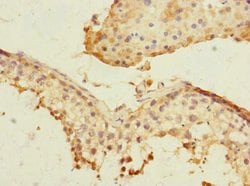 Invitrogen PLK3 Polyclonal Antibody 100 &mu;L; Unconjugated:Antibodies,