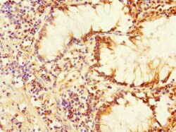 Invitrogen PLK3 Polyclonal Antibody 100 &mu;L; Unconjugated:Antibodies,