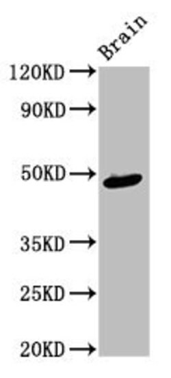 Invitrogen Ameloblastin Polyclonal Antibody 100 &mu;g | Buy Online | Invitrogen&trade; | Fisher Scientific