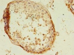 Invitrogen KBTBD4 Polyclonal Antibody 100 μg; Unconjugated:Antibodies,