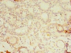 Invitrogen KBTBD4 Polyclonal Antibody 100 μg; Unconjugated:Antibodies,