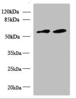 Invitrogen KBTBD4 Polyclonal Antibody 100 μg; Unconjugated:Antibodies,