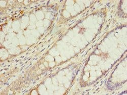 Invitrogen TRSPAP1 Polyclonal Antibody 100 μg; Unconjugated:Antibodies,