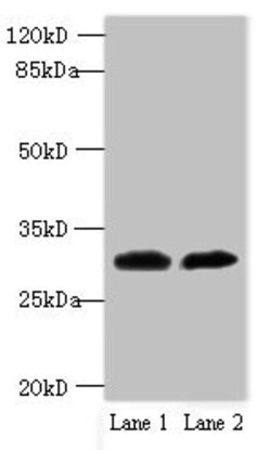 Invitrogen TRSPAP1 Polyclonal Antibody 100 μg; Unconjugated:Antibodies,