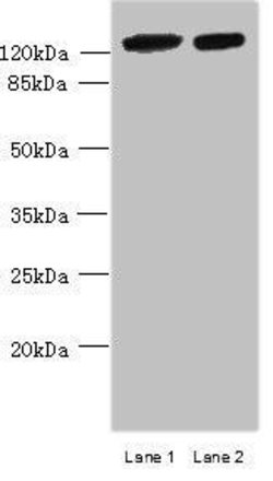 Invitrogen MCM9 Polyclonal Antibody 100 &mu;g; Unconjugated:Antibodies,
