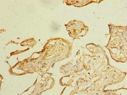 Invitrogen ZDHC3 Polyclonal Antibody 100 μg; Unconjugated:Antibodies,