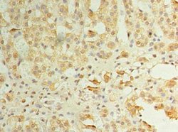 Invitrogen ZDHC3 Polyclonal Antibody 100 μg; Unconjugated:Antibodies,