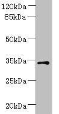 Invitrogen ZDHC3 Polyclonal Antibody 100 μg; Unconjugated:Antibodies,
