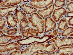 Invitrogen HAO2 Polyclonal Antibody 100 &mu;g; Unconjugated:Antibodies,