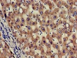 Invitrogen HAO2 Polyclonal Antibody 100 &mu;g; Unconjugated:Antibodies,