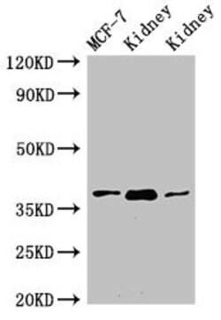 Invitrogen HAO2 Polyclonal Antibody 100 &mu;g; Unconjugated:Antibodies,