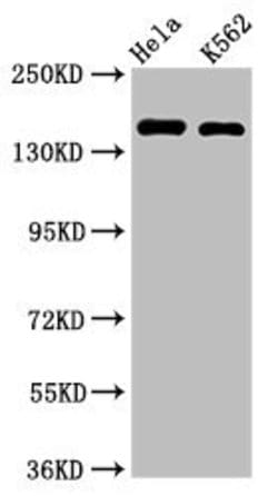 Invitrogen CDK12 Polyclonal Antibody 100 &mu;g; Unconjugated:Antibodies,