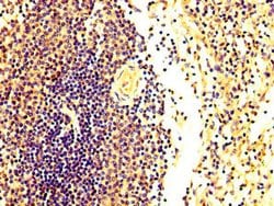 Invitrogen FASTKD2 Polyclonal Antibody 100 &mu;g; Unconjugated:Antibodies,