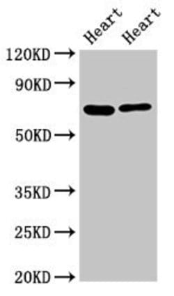 Invitrogen FASTKD2 Polyclonal Antibody 100 &mu;g; Unconjugated:Antibodies,