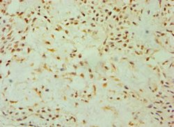 Invitrogen DKK4 Polyclonal Antibody 100 μL; Unconjugated:Antibodies,