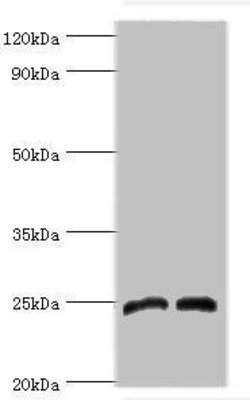 Invitrogen DKK4 Polyclonal Antibody 100 μL; Unconjugated:Antibodies,