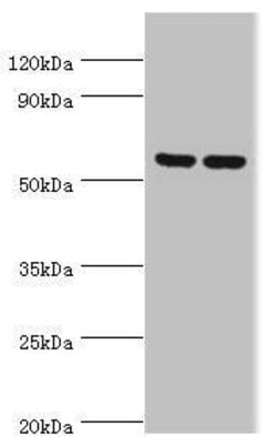 Invitrogen AMPK gamma-3 Polyclonal Antibody 100 &mu;L; Unconjugated:Antibodies,