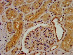 Invitrogen DMGDH Polyclonal Antibody 100 &mu;g; Unconjugated:Antibodies,