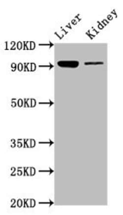 Invitrogen DMGDH Polyclonal Antibody 100 &mu;g; Unconjugated:Antibodies,