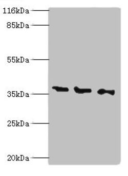 Invitrogen NAGK Polyclonal Antibody 100 μg; Unconjugated:Antibodies,